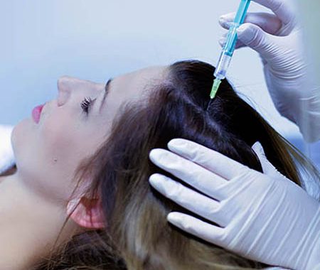 Mezoterapia igłowa skóry głowy